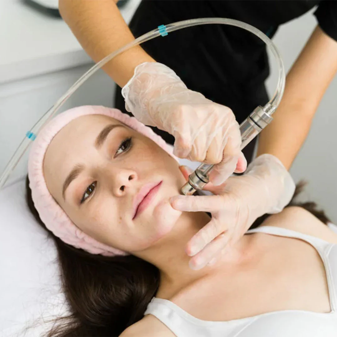Microneedling RF