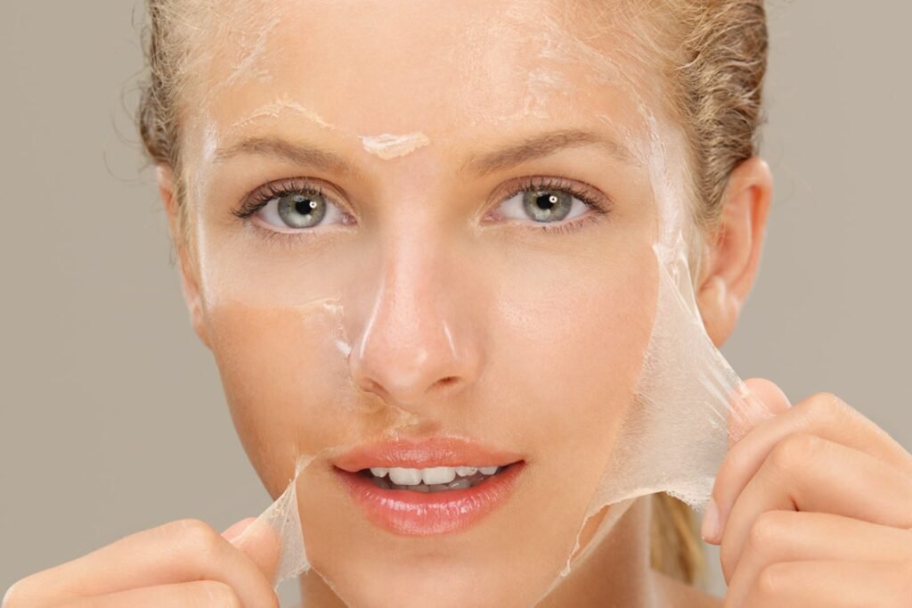 Skin Peels
